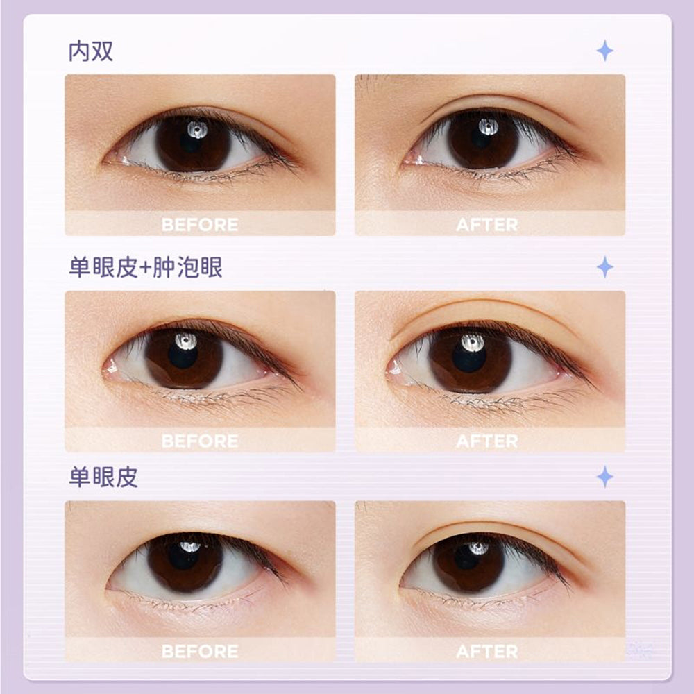 Everbab-Traceless-Eyelid-Sticker-M-Shape---400-Pieces-1